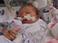 Congenital Diaphragmatic Hernia Research