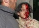 Breaking News: Israel Bombs UN School, Kills Dozens