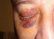 Fight Club Atrocity Update