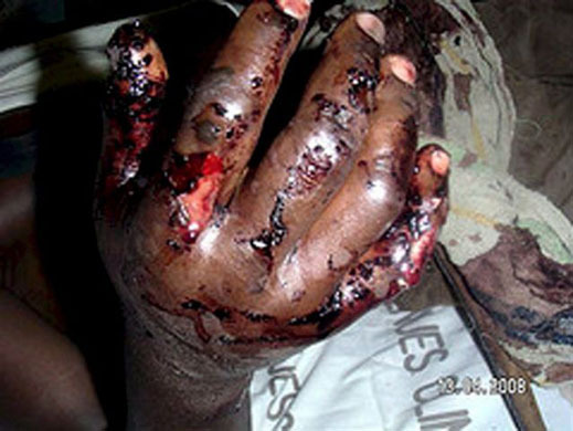 ZIMBABWE POST ELECTION VIOLENCE